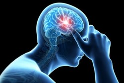 سکته مغزی چه زمانی رخ می‌دهد؟ + فیلم
