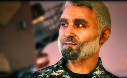 فیلمی جالب از نحوه‌ی عمل جراحی افزایش قد!