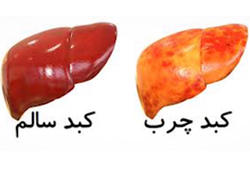 بلای وحشتناکی که فست فود بر سر مردم اوکراین آورده است + فیلم