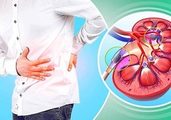 ساختار کلیه و نقش مهم آن در بدن + فیلم