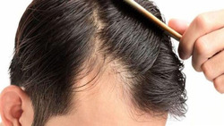 رژیم غذایی و سلامت مغز + فیلم