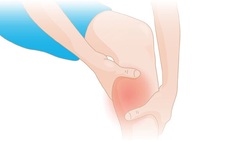علت گرفتگی عضلات از زبان متخصص + فیلم