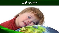 روز جهانی سندروم داون