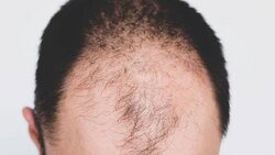 تغذیه مناسب در ماه رمضان از دیدگاه طب ایرانی + فیلم