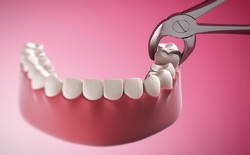 طعمه شدن مار توسط یک عنکبوت + فیلم