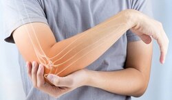 شانه یخ‌زده چیست؟ + فیلم