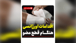 در صورت سوختگی چه کارهایی باید انجام داد؟ + فیلم