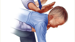 نجات کودک از خفگی توسط پدرش + فیلم