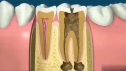 راهکار یک راننده کامیون برای کاهش میزان تصادف + فیلم