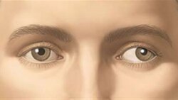 هنگام سوختگی یا آسیب‌ های چشمی چه کار‌هایی باید انجام دهیم؟ + فیلم