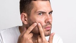 راه های درمان ریزش مو و موخوره در طب سنتی + فیلم