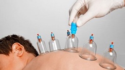 حجامت آلرژی برای رفع حساسیت بهاره + فیلم