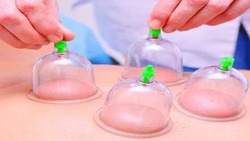 آیا اهدای خون می‌تواند جایگزین حجامت باشد؟ + فیلم