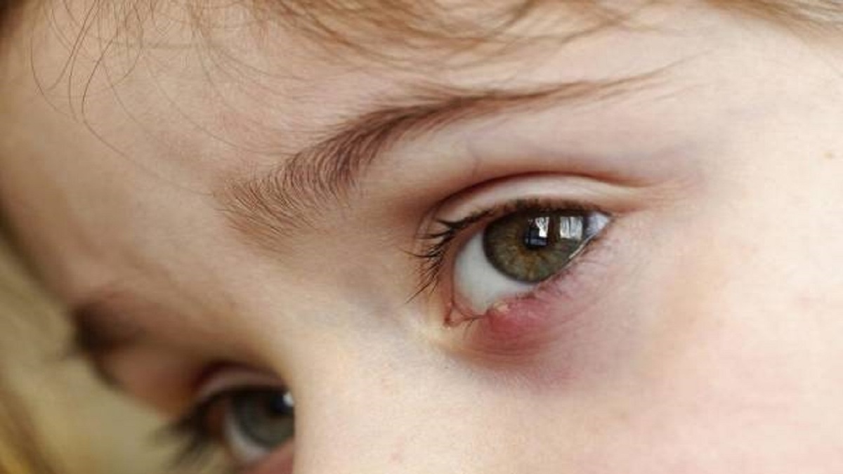 ورزش چشم برای افراد بالای ۵۰ سال + فیلم