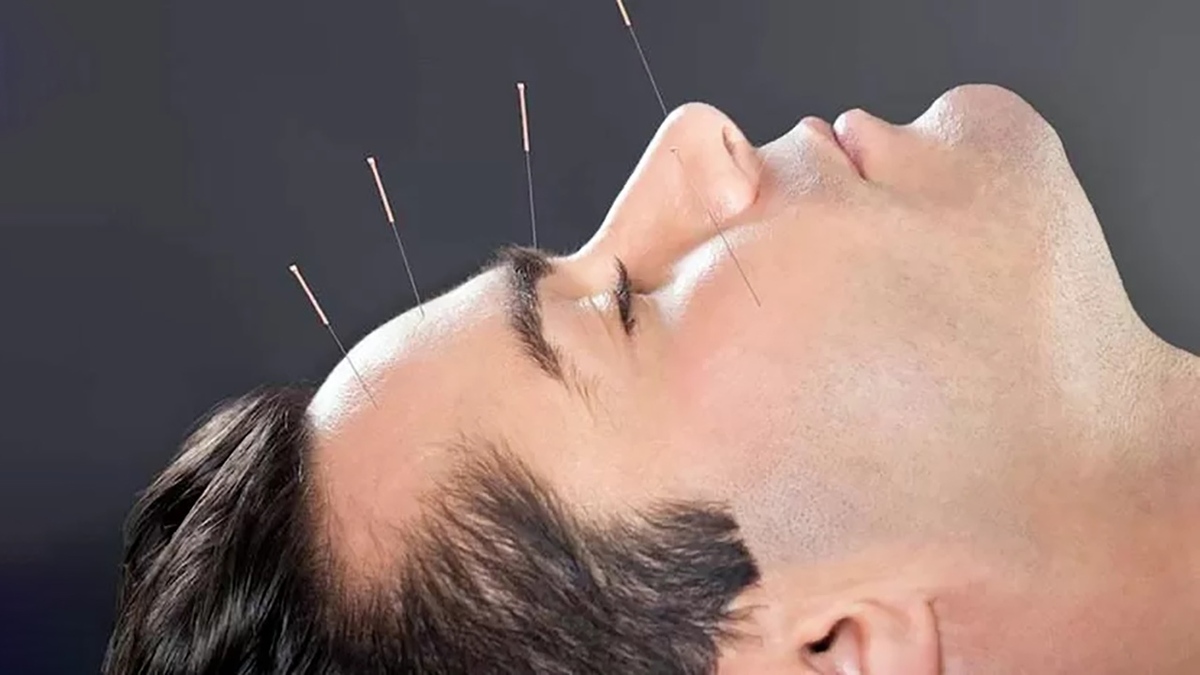 آموزش ساخت صابون برای پوست چرب + فیلم