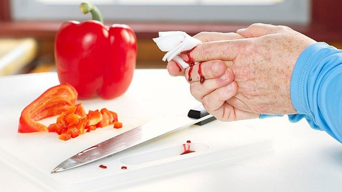 حاصل لجبازی خودرو با دوچرخه + فیلم