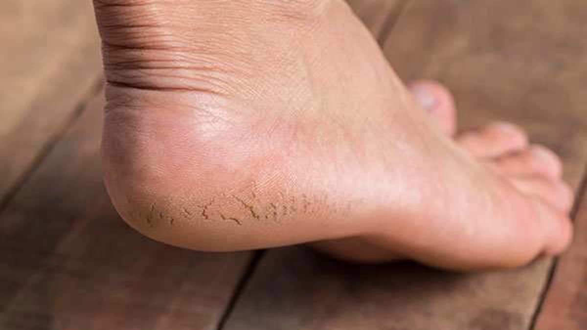 مواد غذایی موثر در کنترل اضطراب ناباروری